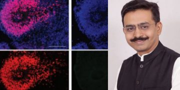 Rajeev Satav cytomegalovirus