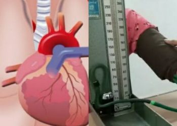 उच्च रक्तदाब