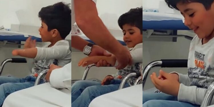 childs first prosthetic hand