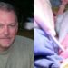 Successfully Pig Kidney Transplant on Brain Dead Patient