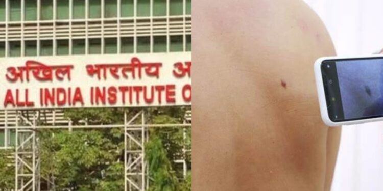 AIIMS APP for skin diseases