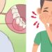 Toothache Home Remedies