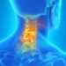 neck pain